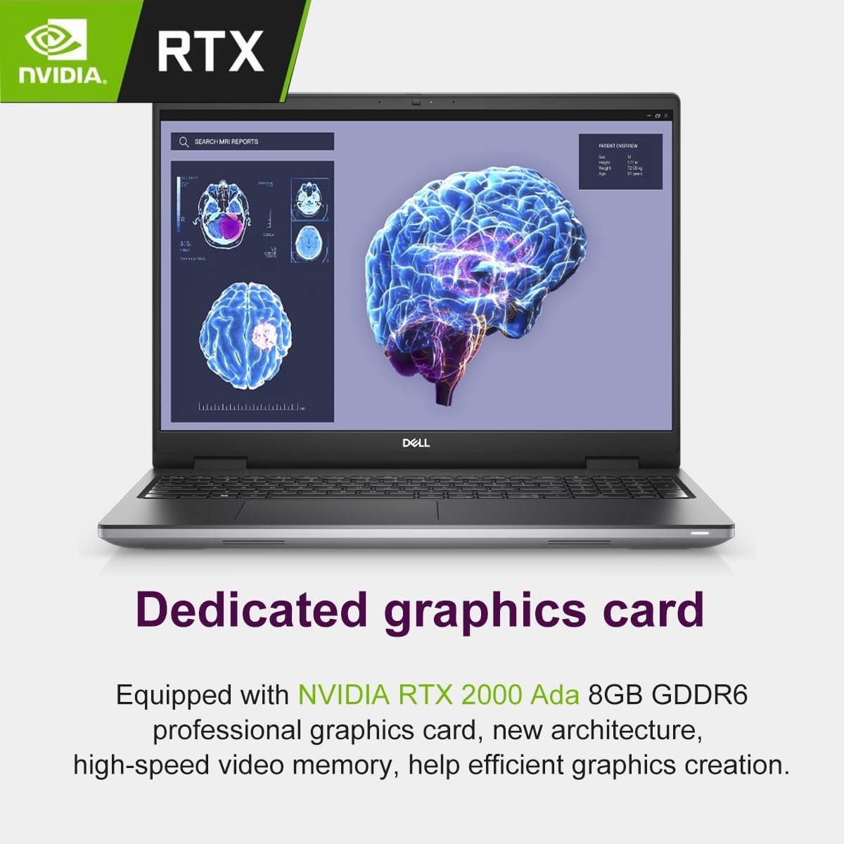 Dell Precision 7000 7680 Mobile Workstation Laptop (NVIDIA RTX 2000 Ada 8GB, 16' FHD+, Intel 20-Core i7-13850HX (> Ultra 9-185H), 32GB LPCAMM2 DDR5, 2TB SSD) Pro Max for Designer, IST HUB, Win 11 Pro